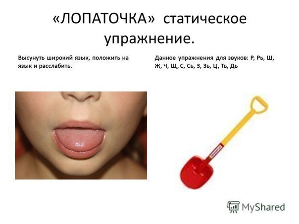 ЛОГОПЕДИЧЕСКИЕ УПРАЖНЕНИЯ