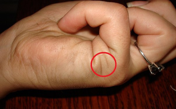 А сколько у Тебя линий в этом месте 